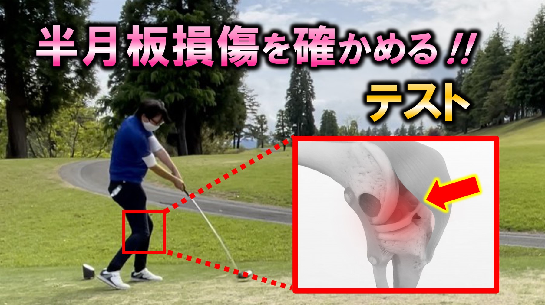 ゴルフによる膝の半月板損傷が疑われるときの徒手的テスト